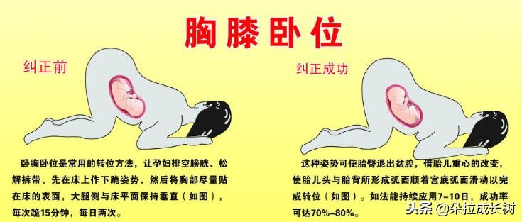 怀孕几周检查胎位正不正,怀孕几周胎位才会固定