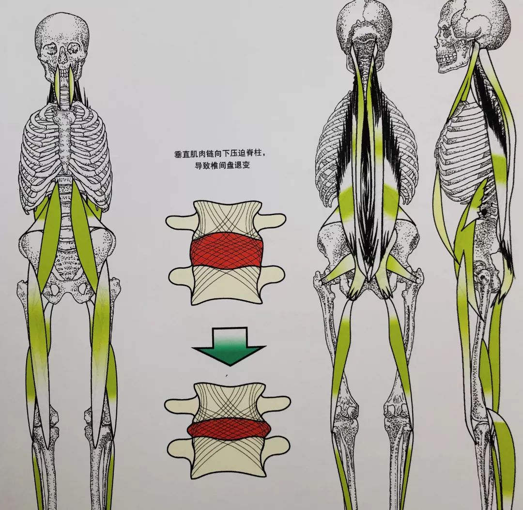 完美的运动模式——肌肉链运动