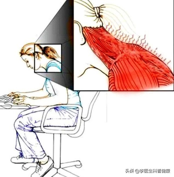 右侧后背僵硬肩胛骨下边疼,右后背肩胛骨下方僵硬是咋回事