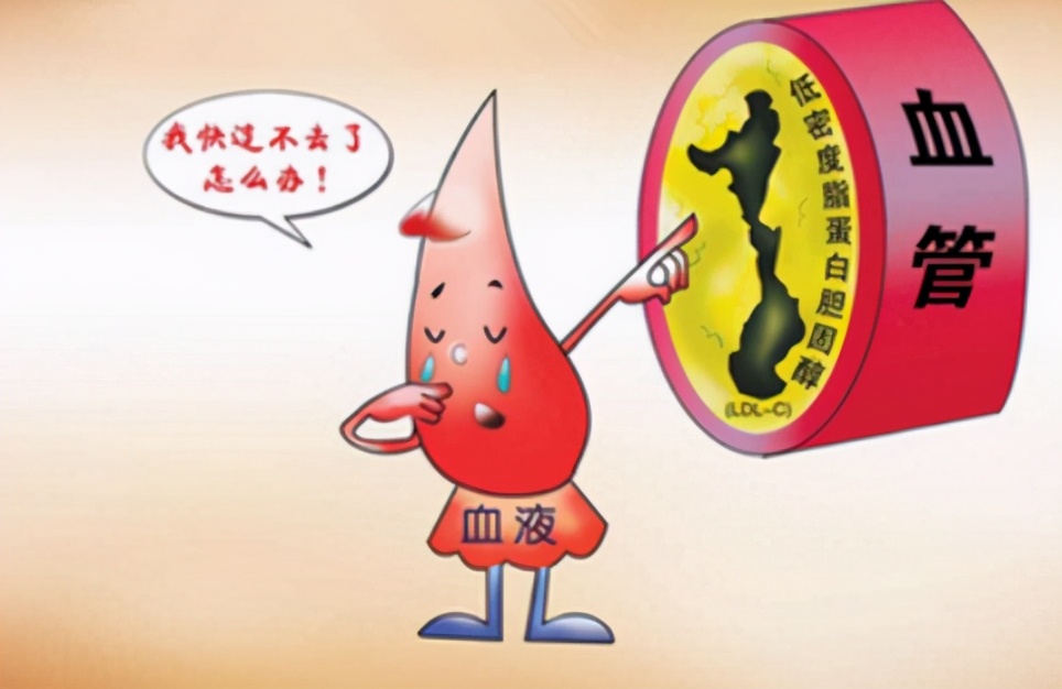 乳腺癌患者有三高怎么办,乳腺癌能摄入高蛋白饮食吗