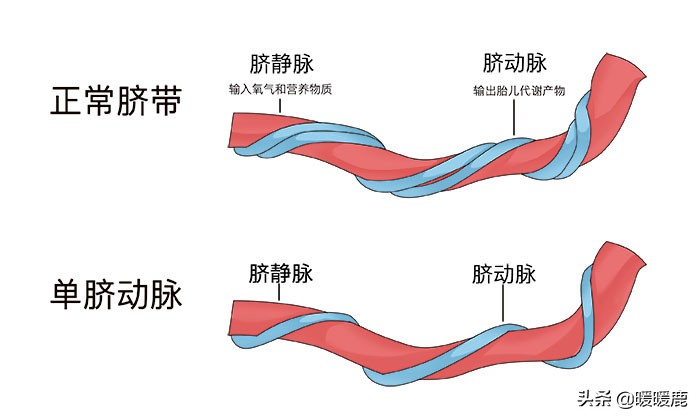 孕期如何通过b超看胎儿大小,三分钟看懂孕期b超图
