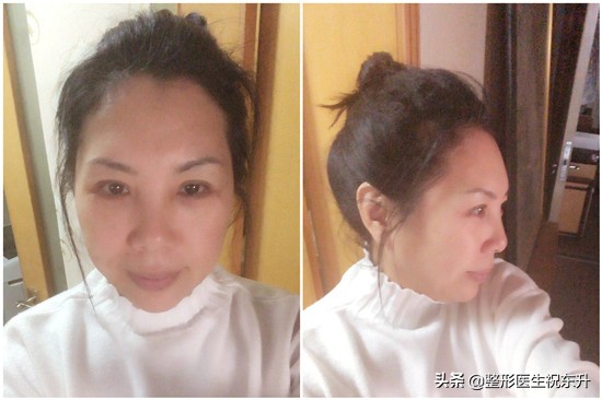 做眼袋用什么护肤品,眼袋大怎么办用什么眼霜好