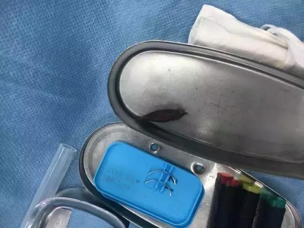 儿童误吞玻璃死亡,孩子误吞了碎玻璃怎么办