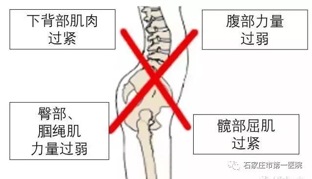 翘臀错误练法,翘臀不正常是什么原因