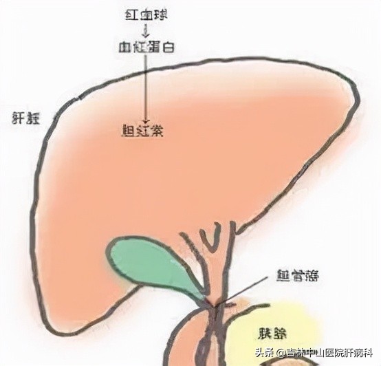 胆红素升高怎么办,胆红素升高怎么办呢