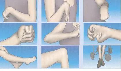 卒中康复后需要注意什么,卒中后痉挛表现和产生原因