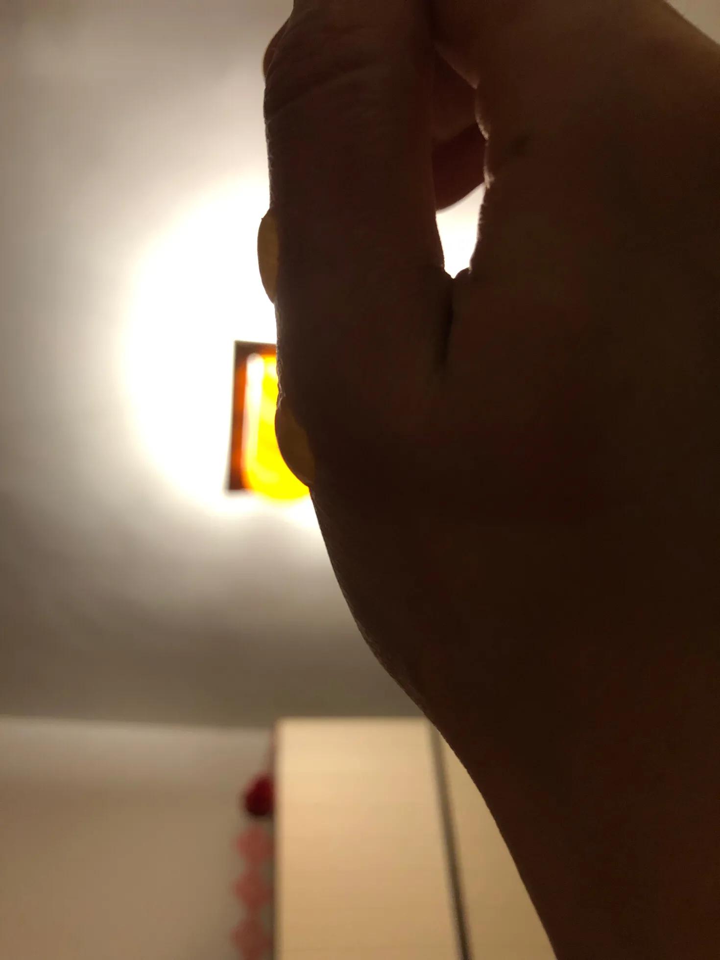 疫情期间低温烫伤的水泡怎么处理,烫伤后二十二天基本都平了