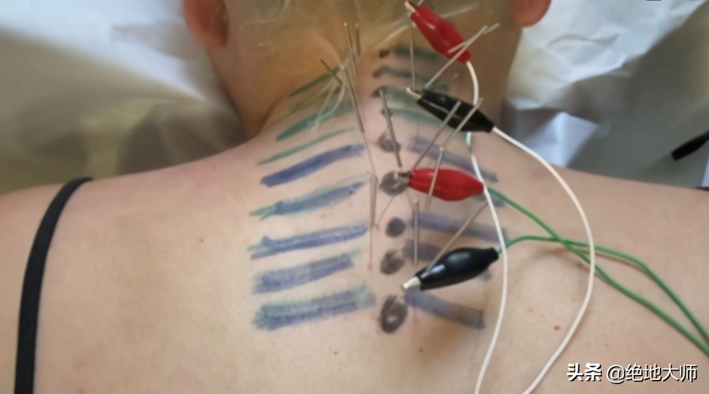 手神经外伤康复视频,治疗手神经损伤的药