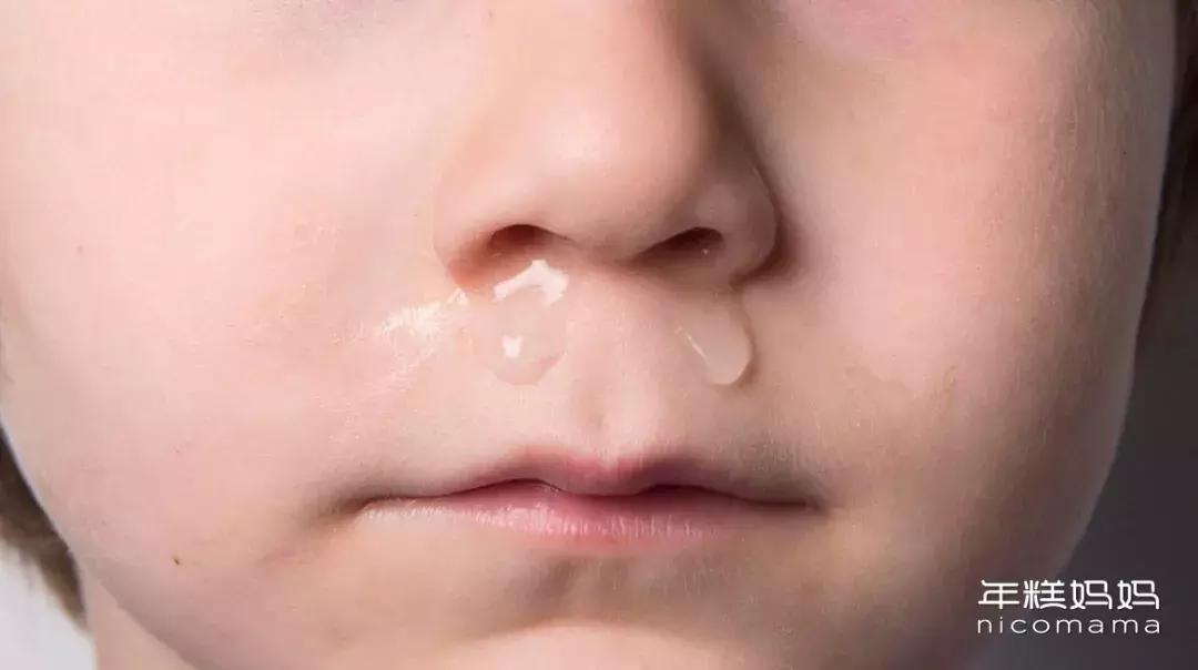 小孩鼻涕最简单的解决方法,流脓鼻涕切莫忽视