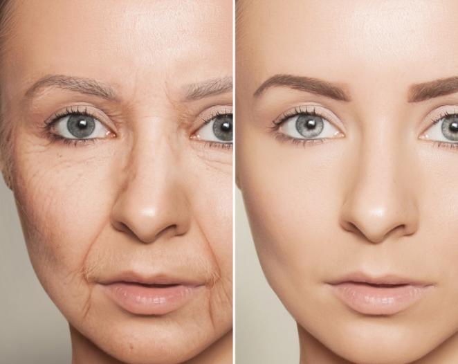 凡士林哪款可以用来擦脸,凡士林正确擦脸方法