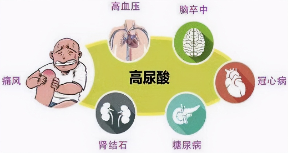 有胆结石饮食上要注意什么,胆结石的常见饮食预防方法