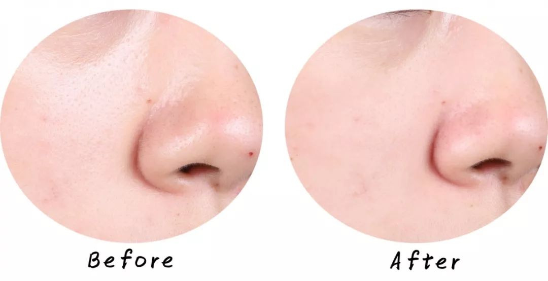 十大清洁面膜排行榜混合性皮肤,十大好用清洁面膜