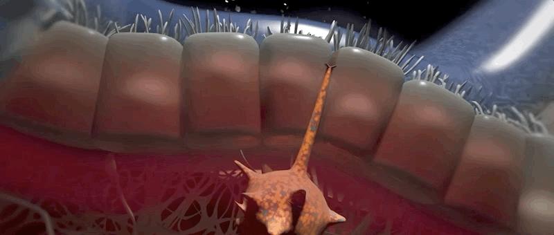 哮喘的发病原理,哮喘科普文章作品简介