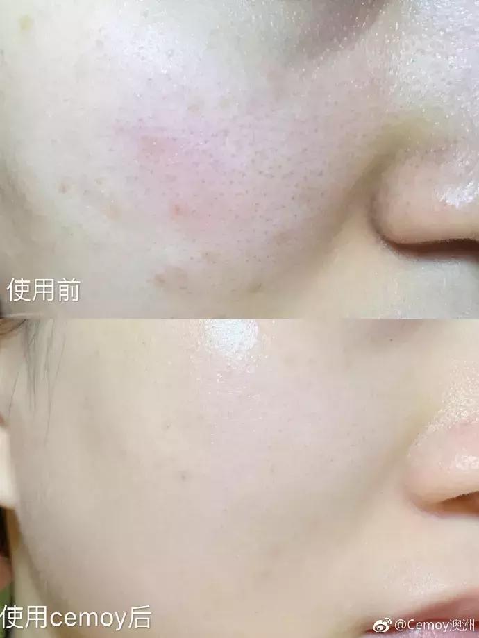 王鸥推荐的精华水,欧阳娜娜推荐的乳霜