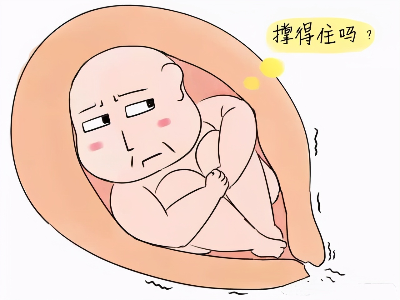 先天性宫颈机能不全是孕晚期疾病,宫颈机能不全是早产多还是流产多