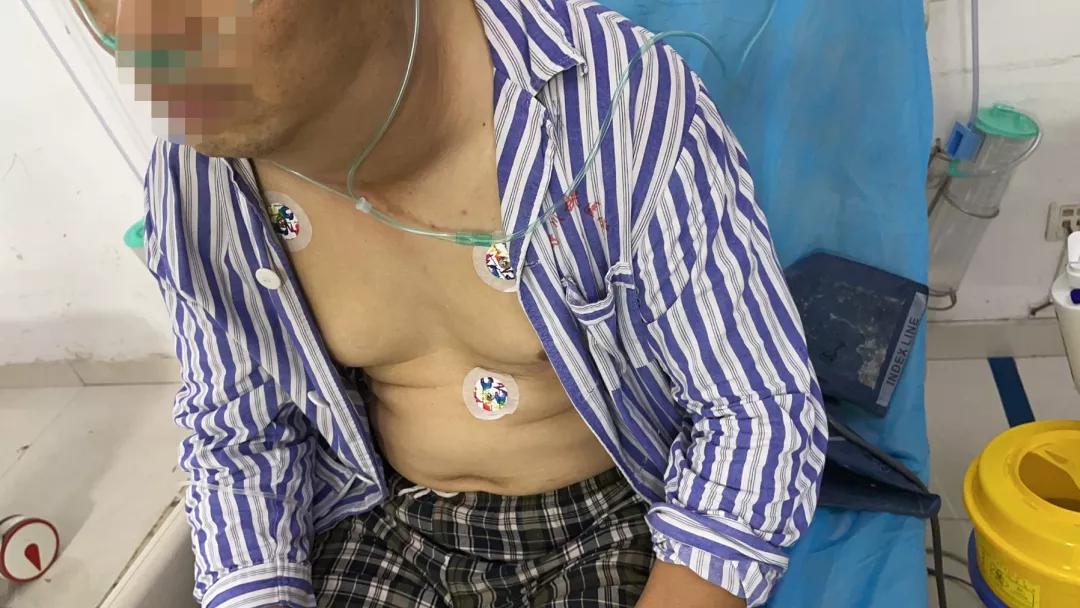 河科大一附院重症内科,河科大一附院康复治疗