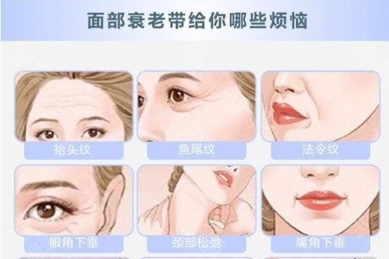 颈部拉皮除皱有什么危害,拉皮手术除皱可维持多久