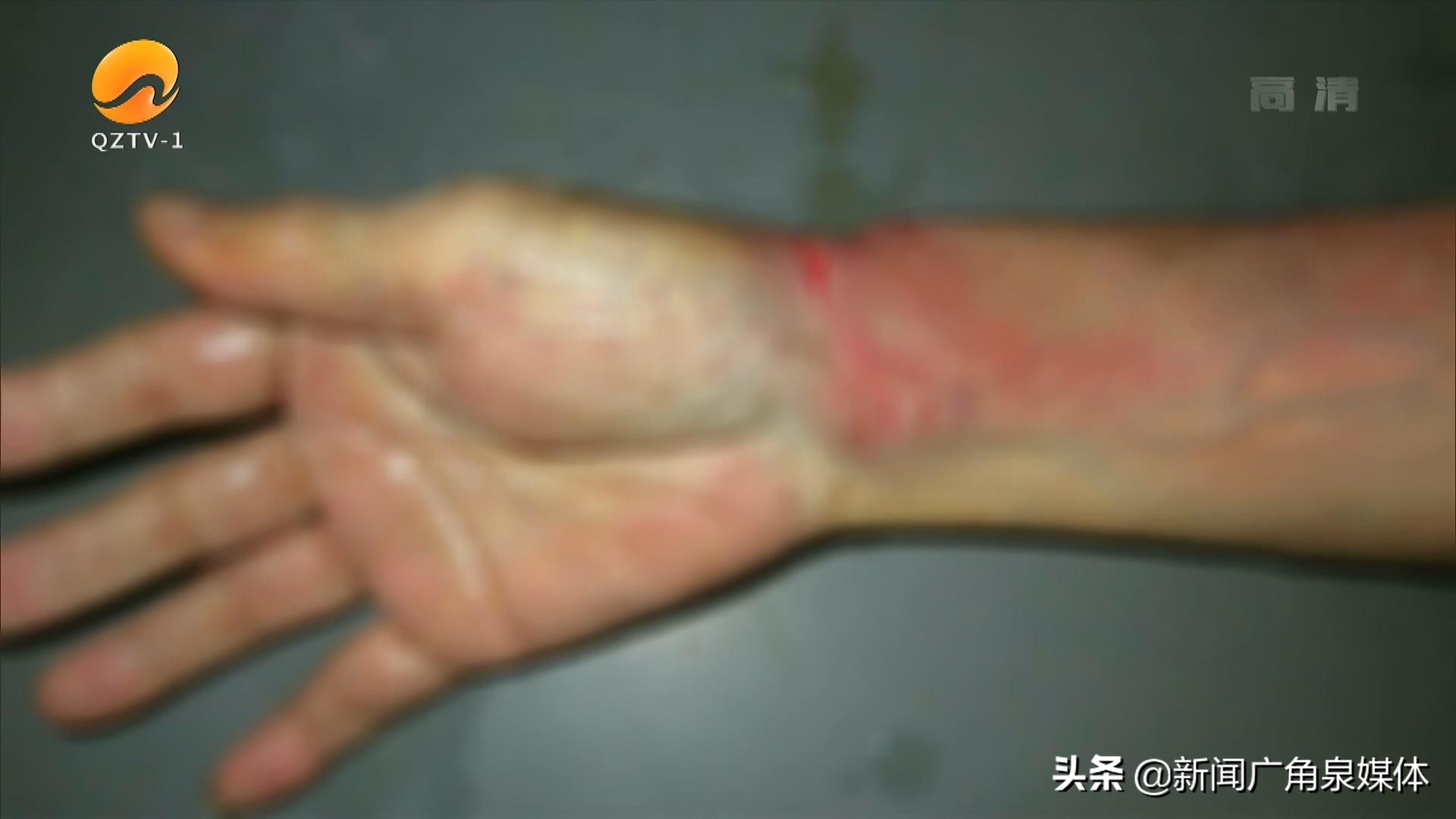 狗狗被大狗咬男子用棍子救命,宠物狗突然攻击小主人