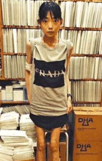 伍智恒患病前后对比图,伍智恒减肥前后照片