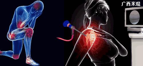 骨科大夫米琨为您详解:关节痛了怎么办?