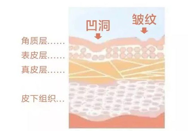 女人多少岁开始变老变丑,女性变丑的五个原因