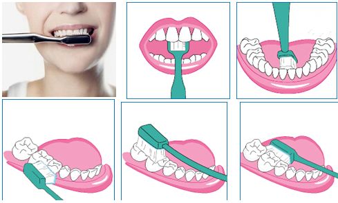 刷牙方式不对导致牙齿有条沟,错误的刷牙方式牙齿还能刷白嘛