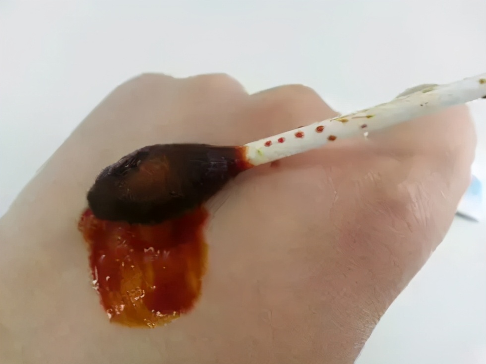 碘酊和碘伏的区别和注意事项，村医别搞错了