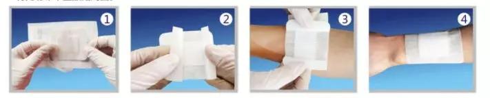 运动擦伤预防及处理的视频,运动擦伤正确处理方法动画