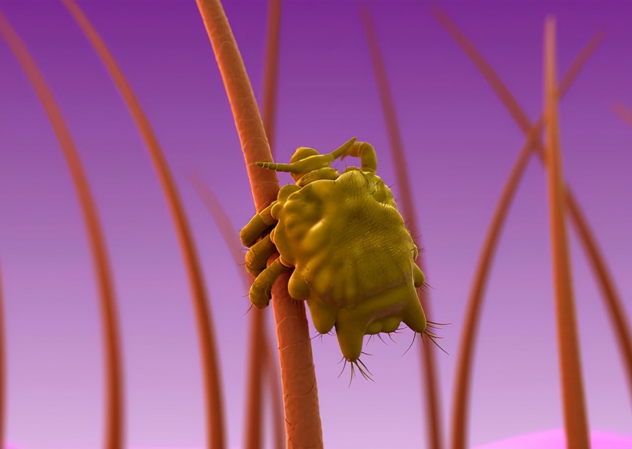 什么情况下会产生阴虱病,什么是阴虱怎么治