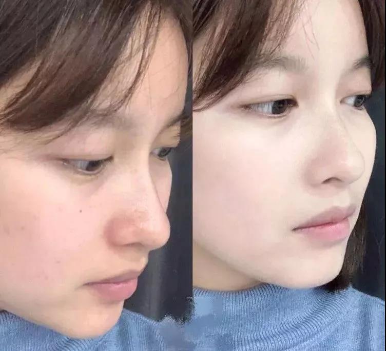 沈梦辰素颜公开惊呆了众多网友,沈梦辰颜值巅峰有多美