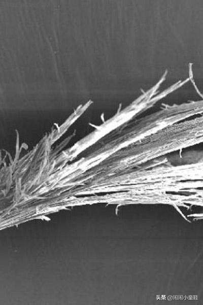 头发分叉与不分叉区别,你还在为头发分叉发愁吗