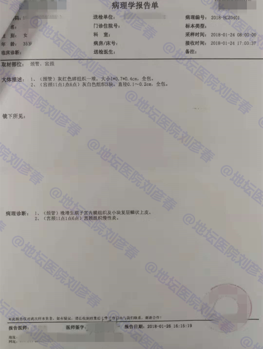 宫颈2-3病变需要切除子宫吗,宫颈16型高级病变要切除子宫吗