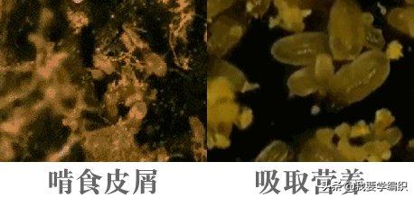 后背长痘的原因和改善方法,后背长痘太可怕了该怎样调理