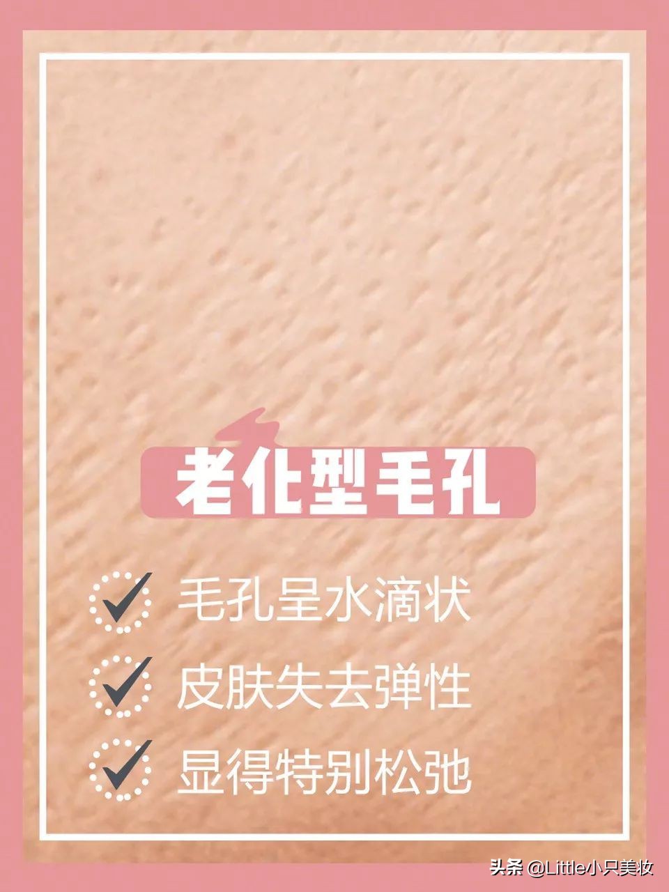 简单几招让你迅速解决粗大毛孔,改善毛孔粗大最有效的办法测评