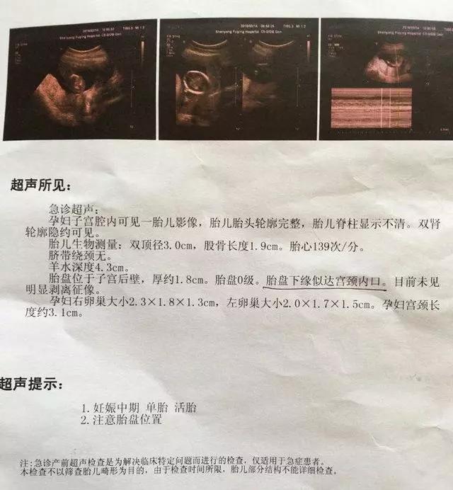 胎盘成熟度分级1-2级到底是几级,b超显示胎盘几级小孩要生了