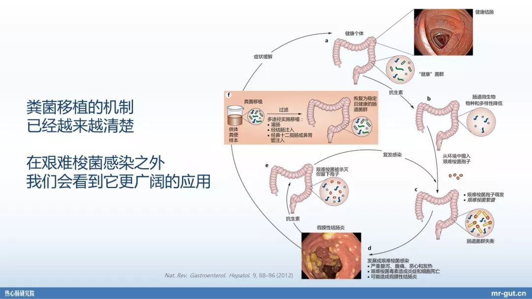 热心肠先生益生菌视频大全,热心肠先生全集