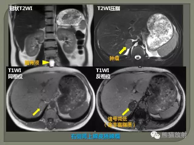 如何简单理解、认识MRI图像