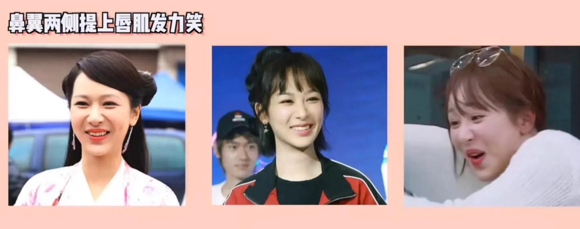 侧颜凸嘴怎么修,让侧脸变好看的方法