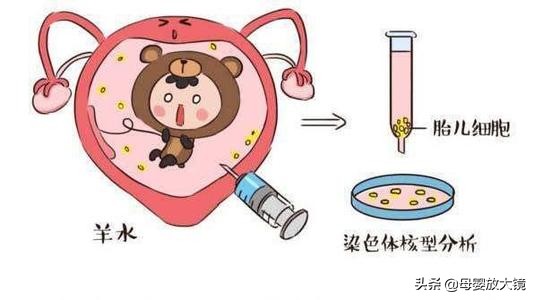 孕期产检:B超,唐筛,羊水穿刺,彩超...什么时间最合适?注意