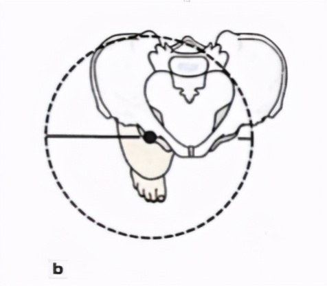 走着走着低头一看,裤子裙子跑偏了?来认领一下是否骨盆旋转