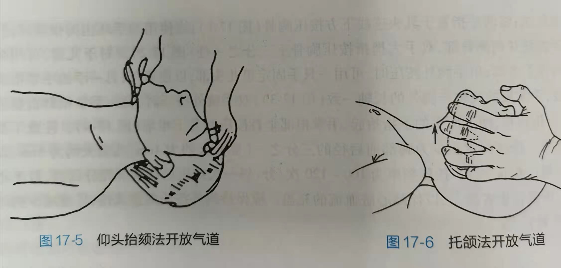 盘江总医院:家长们注意了!藏在幼儿衣物里的“隐形杀手”不容忽视