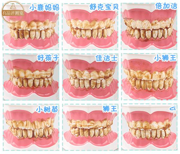 九款儿童电动牙刷测评,9岁儿童牙刷品质