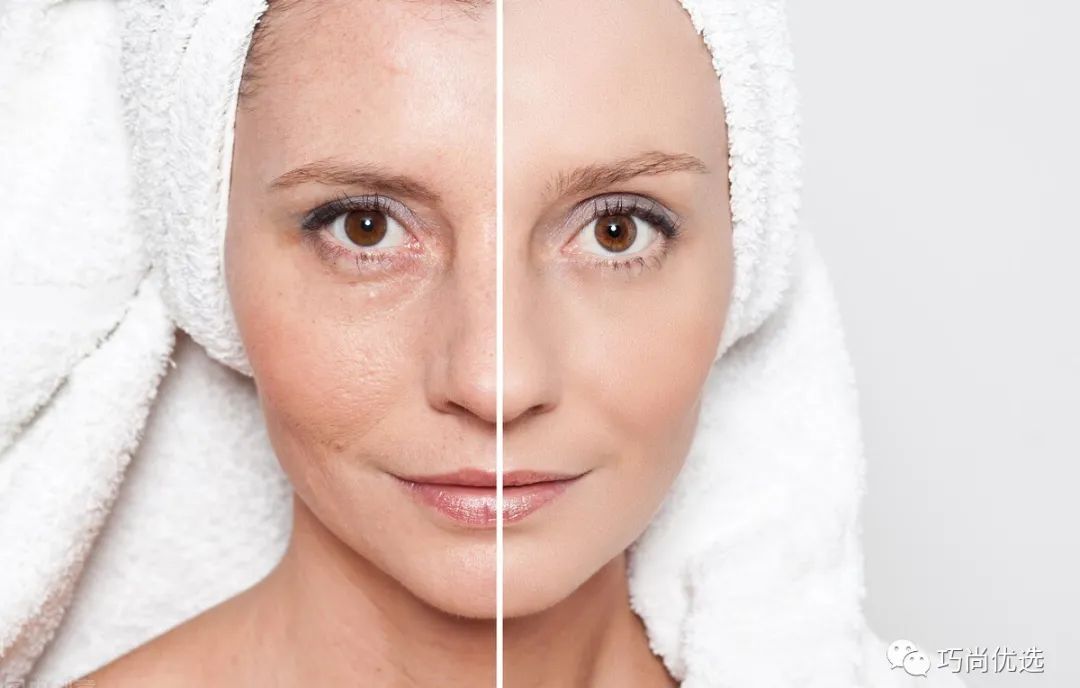 解决毛孔粗大的护肤品十大排名,鼻翼两侧毛孔粗大黑头怎么解决