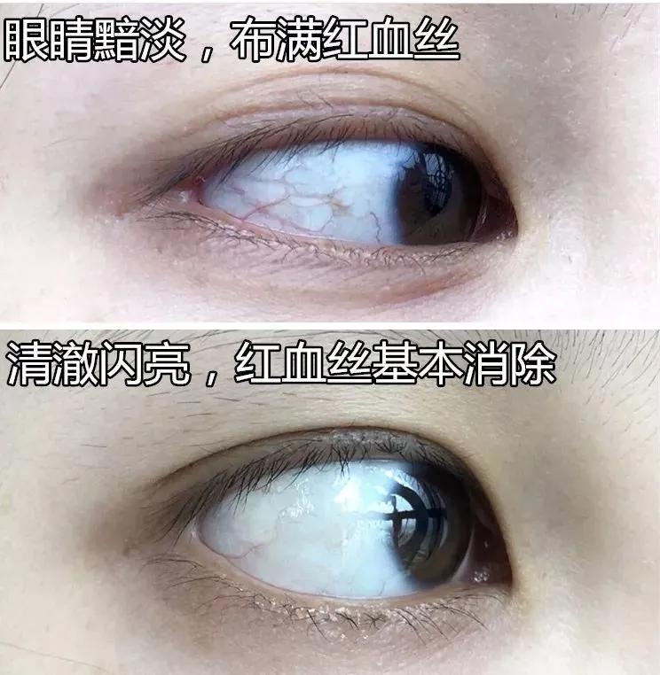 洗眼液使用规范,洗眼注意事项