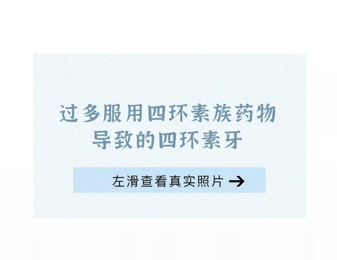 为什么每天刷两次牙还是黄,为什么刷过牙牙还是有点黄