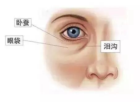 如何分清眼袋和卧蚕的区别图解,卧蚕和眼袋哪个显老