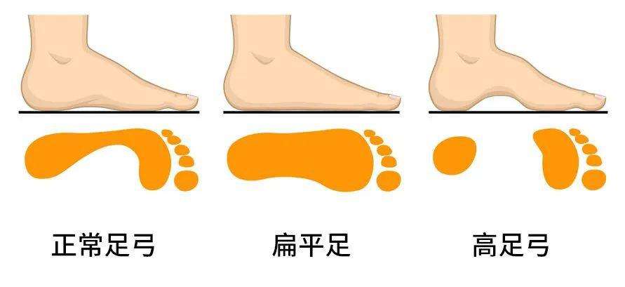 膝关节骨软骨损伤什么原因,膝关节骨关节炎软骨退化康复训练