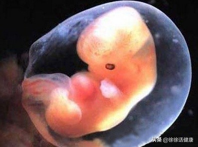 孕7周暂未见胎芽胎心怎么回事,孕7周有胎心胎芽先兆性流产