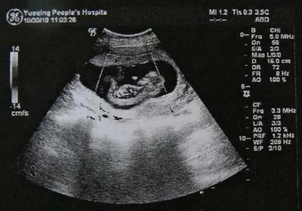 超声的未来,超声设备的发展趋势