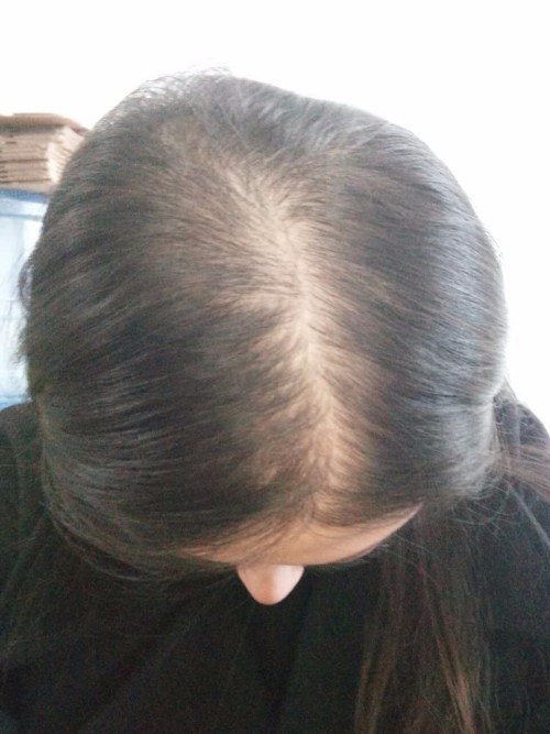 头发为什么越来越细软如何改善,为什么会有特别细软的头发